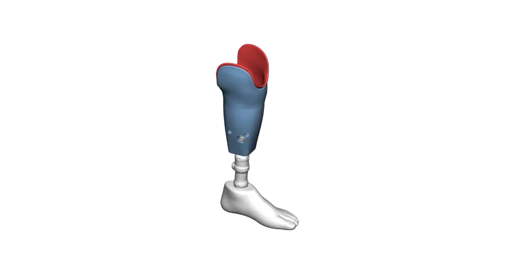 Prosthetic Socket